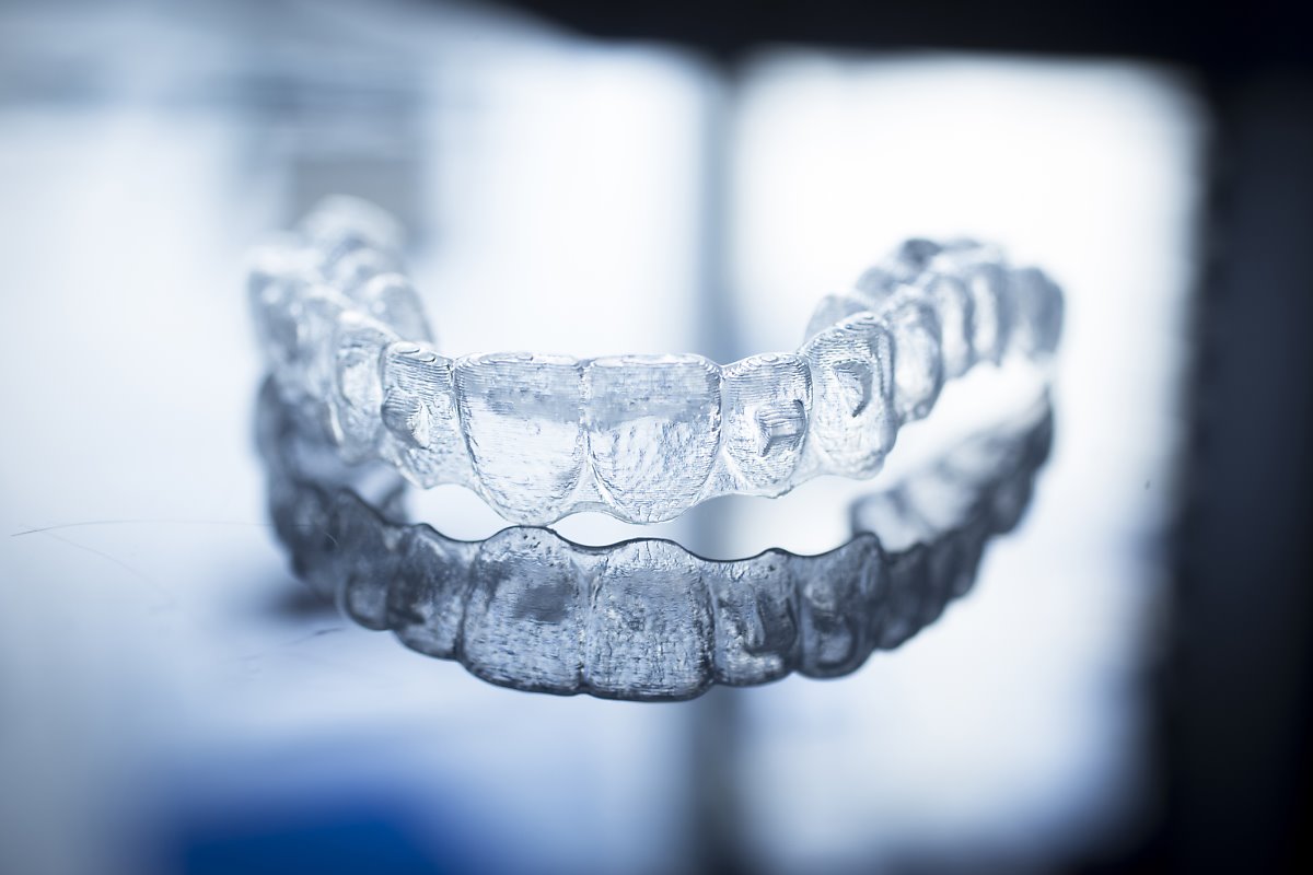 Che cosa è Invisalign e a che cosa serve?