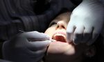 Come fare per avere i denti piu bianchi