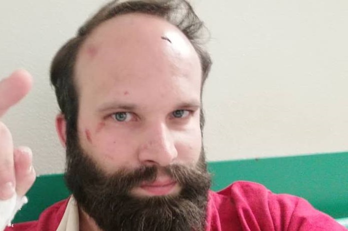 Aggredito a calci e pugni: “Un agguato fascista”