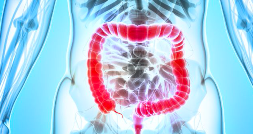 Prevenire il tumore del colon con l’intelligenza artificiale: Humanitas fa scuola nel mondo