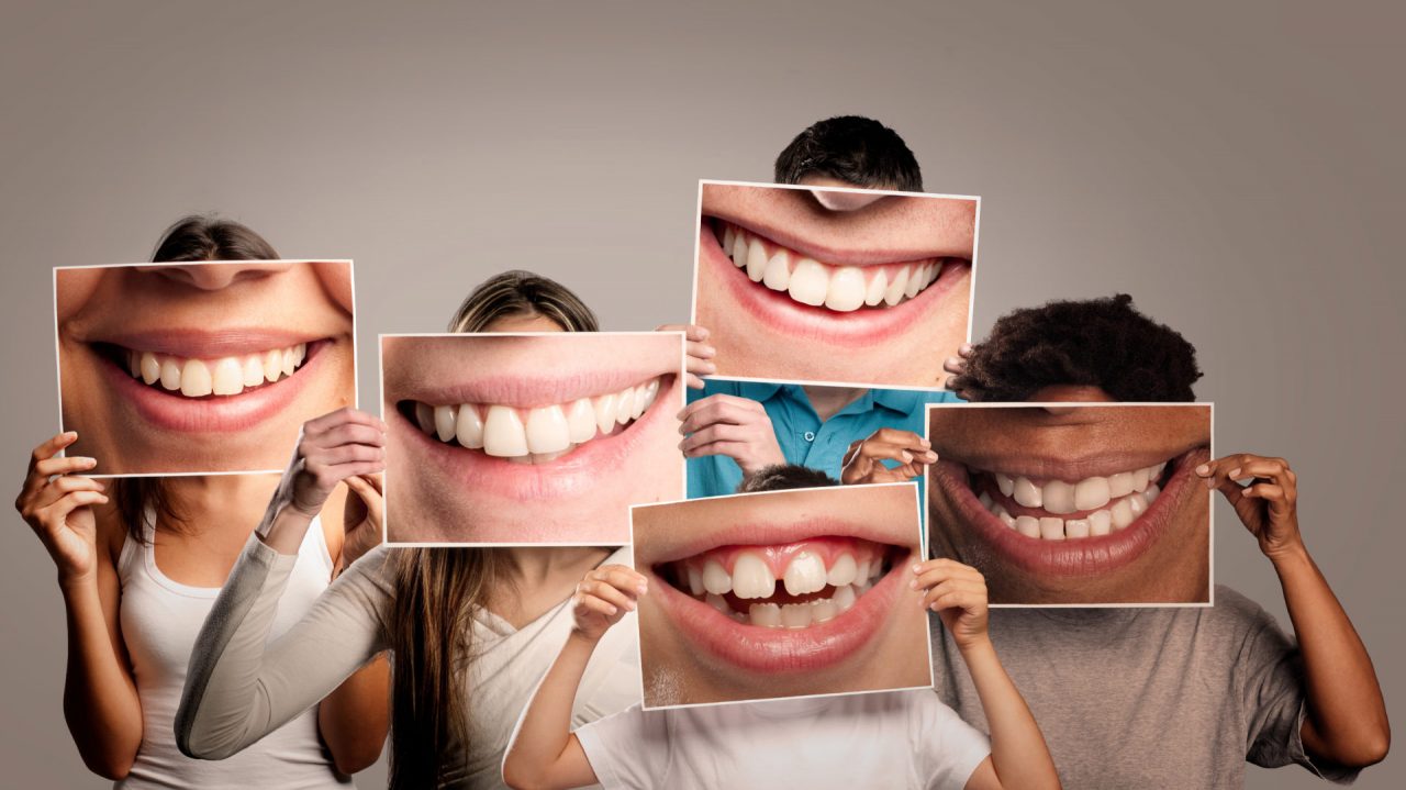 Implantologia dentale: benefici ed innovazioni