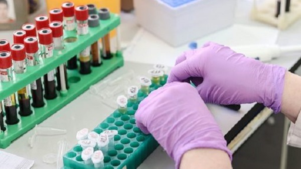 Sindaci del milanese a Fontana: Test sierologici anche a Milano e Città metropolitana