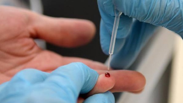 Coronavirus, test sierologici in Lombardia: al via dal 21 aprile