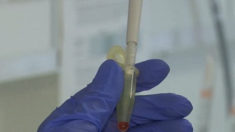 Coronavirus | Già iniziati i test sull’uomo del vaccino italo-inglese