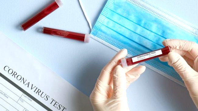 Coronavirus, i Comuni del milanese più colpiti in base agli ultimi aumenti