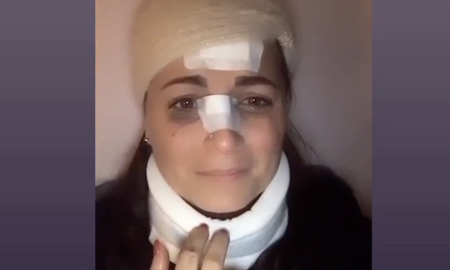 Operatrice sanitaria aggredita sul filobus: “Non si può aver paura di prendere i mezzi” VIDEO