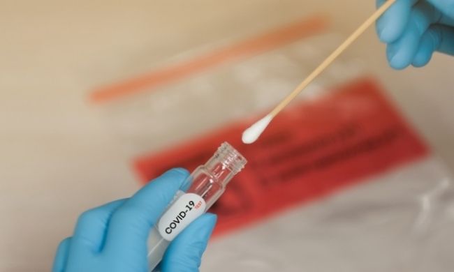 Tamponi rapidi a 12 euro, molecolari a 32: l’offerta del Comune di Assago