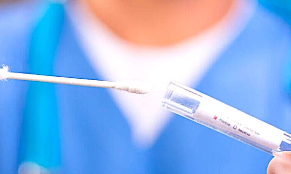 Esplosione di casi: quasi 900 persone a Buccinasco in quarantena