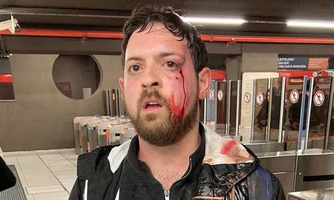 Il presidente del Comitato sicurezza Matthia Pezzoni preso a pugni perché filmava le borseggiatrici in metro