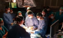 Operazione da record al Policlinico di Milano: asportato un tumore da 42 chili