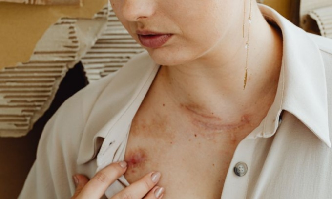 Violenza sulle donne, dati Istat preoccupanti: necessaria una rivoluzione culturale