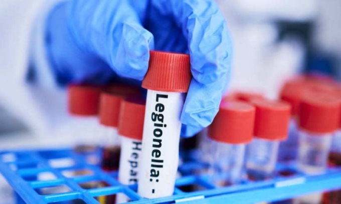 Legionella a Corsico: accertamenti in corso e niente rischi per l’acqua potabile
